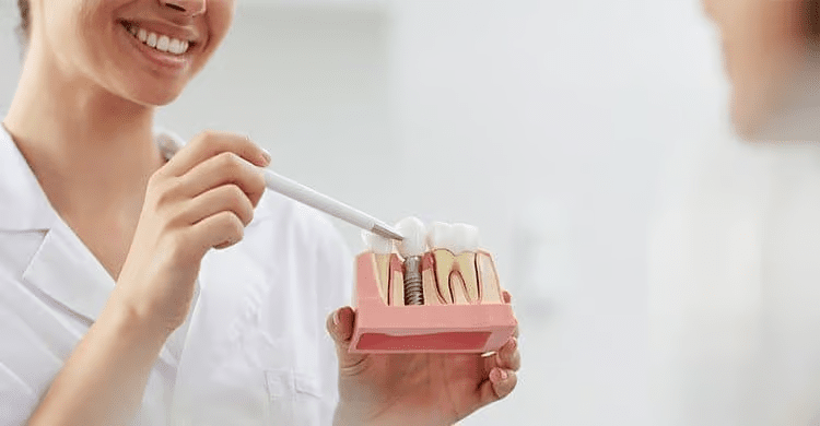 Dental Implants Treatments