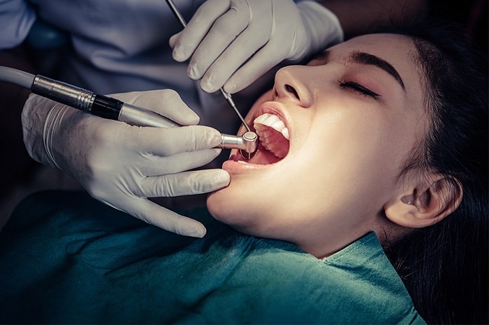 Root Canal Treatment